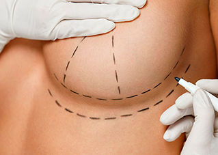Как выглядит грудь сразу после операции?