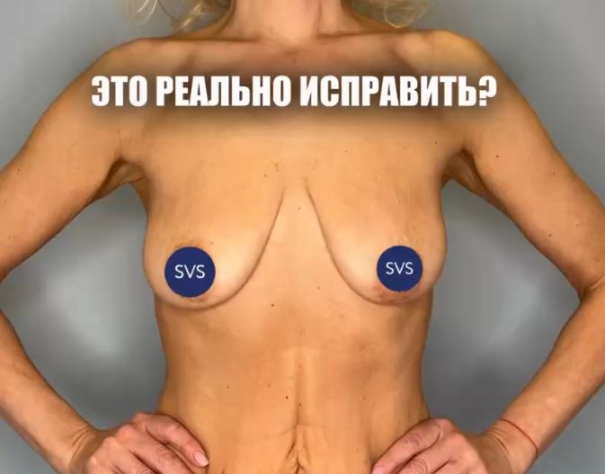 Вернуть свое прекрасное тело и свою любовь к нему реально!  Никогда не сдавайтесь, не бойтесь!