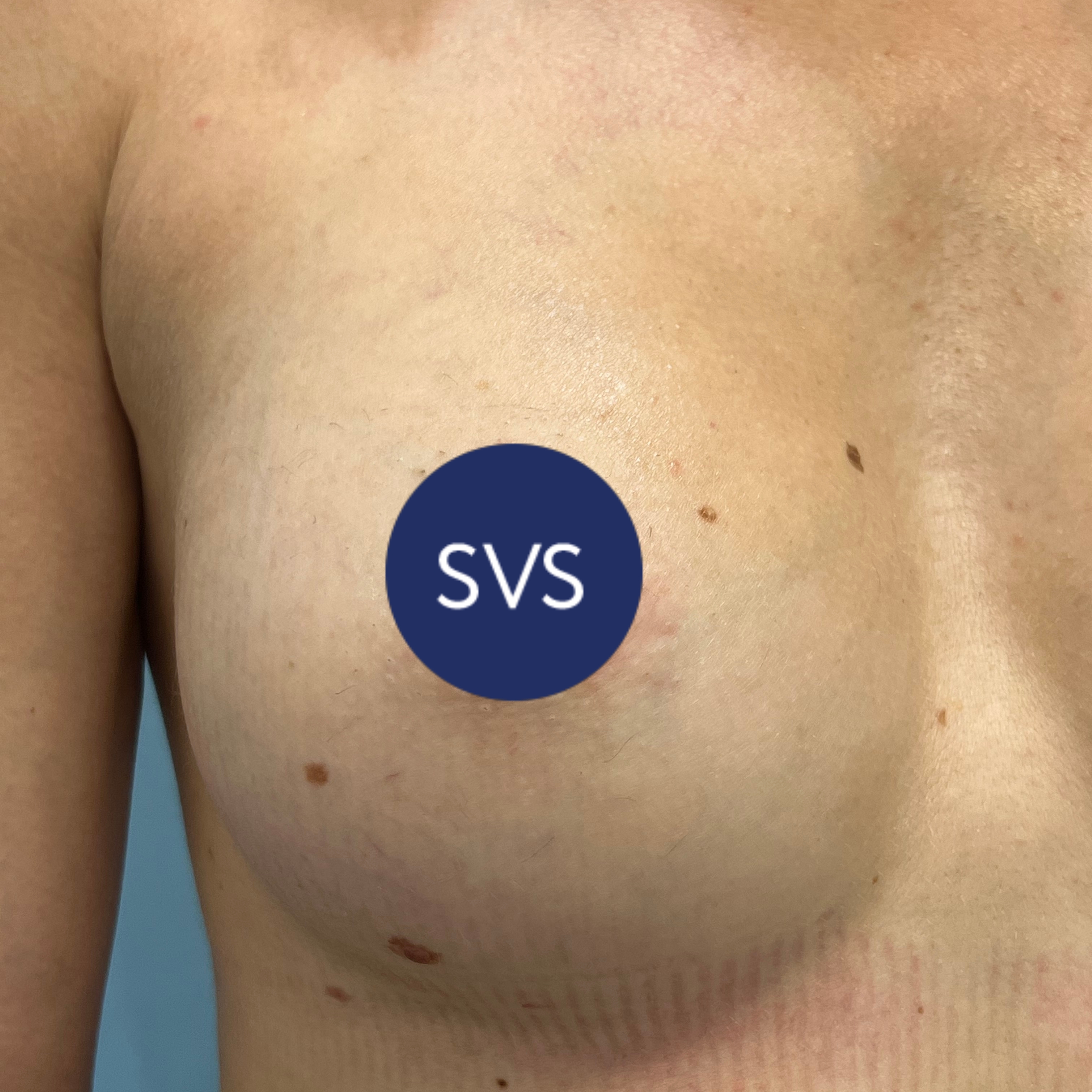 мнения мужчин о силиконовой груди грудь фото 109