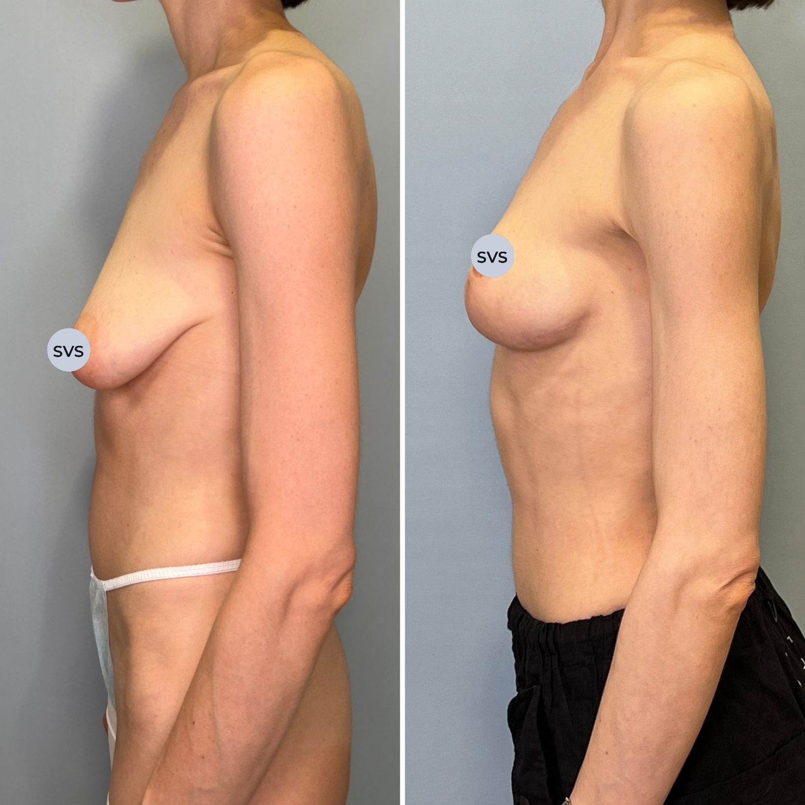 Вы это видите? Результат просто бомбический!