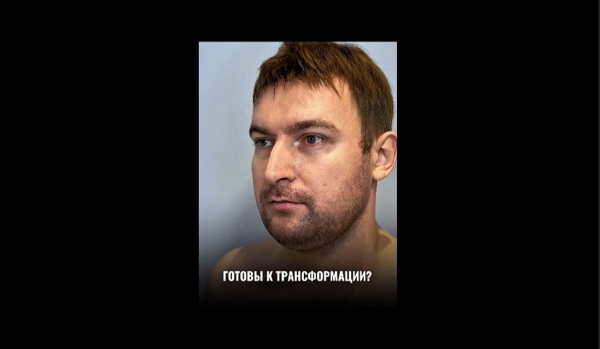 Грыжи. Липофилинг.