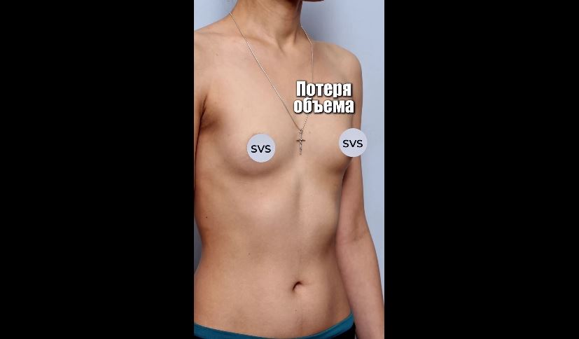 Пациентка №145_23893