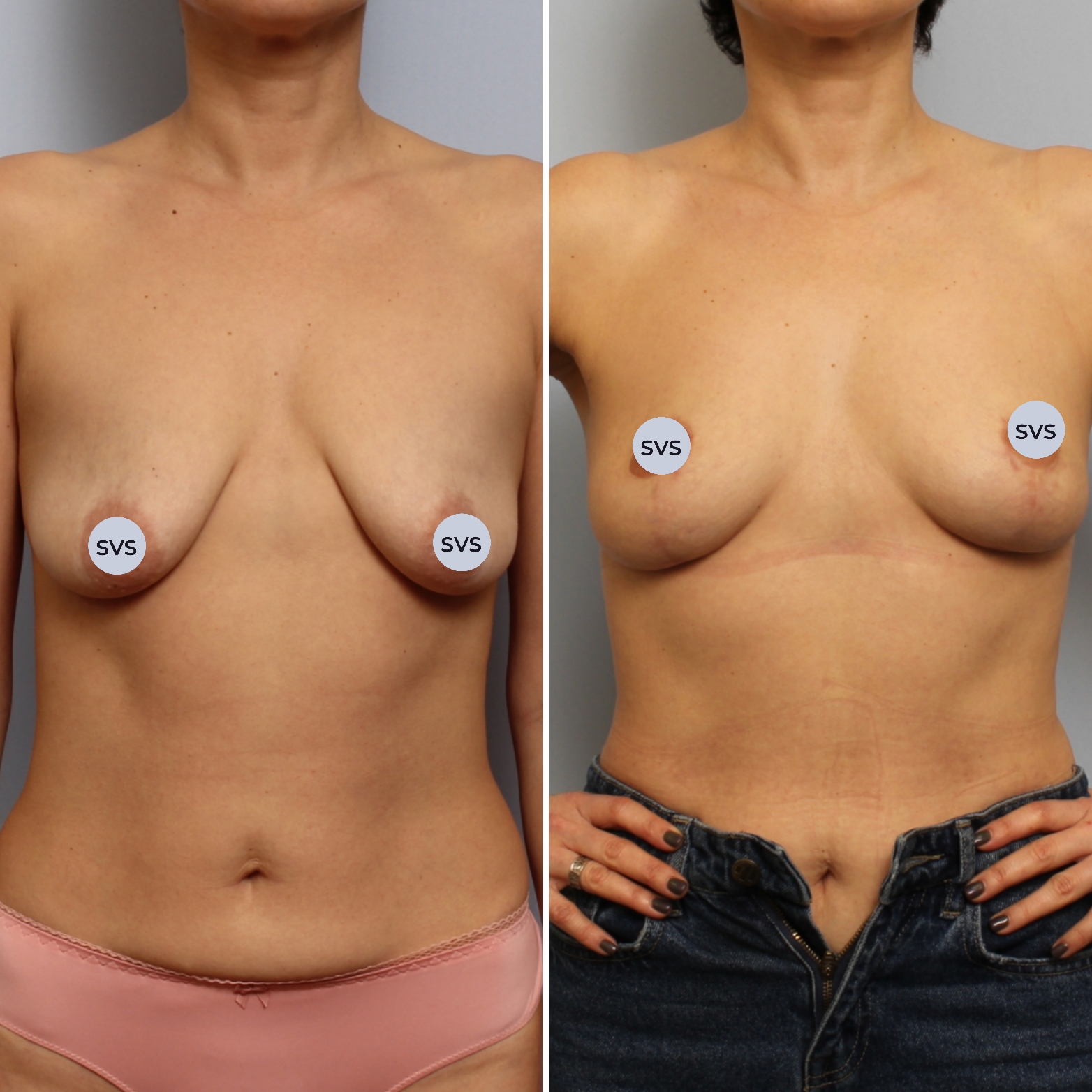 подтяжка груди с гантелями для женщин фото 8