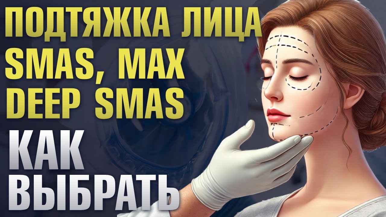 Подтяжка лица: SMAS Лифтинг, Спейслифтинг, Macs, Deep SMAS - в чем разница?