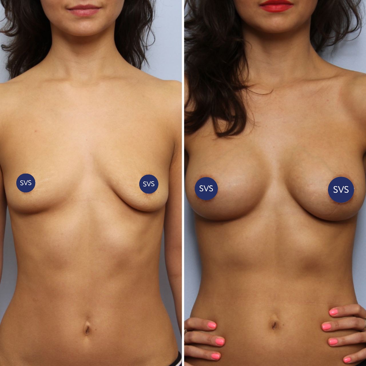 Идеальная грудь - это…?