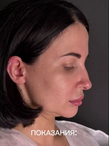 Я знаю, что многие напишут: «я ничего не делала». 