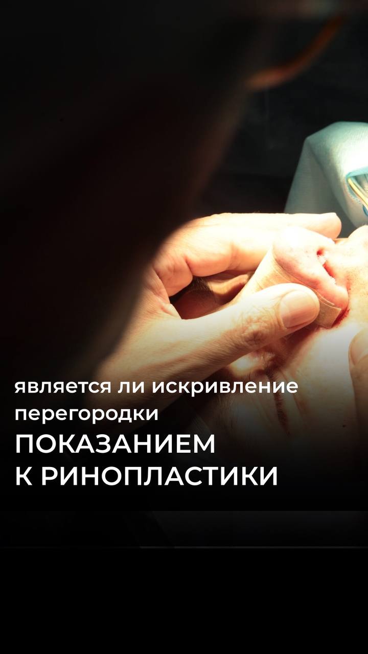 Является ли искривление перегородки показанием для РИНОПЛАСТИКИ?