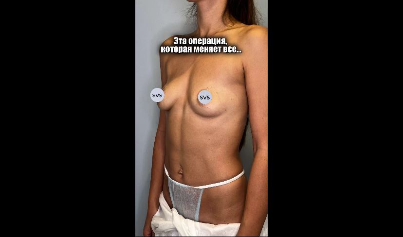 Пациентка №152_23916