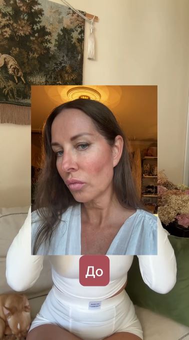 Невидимая пластика лица