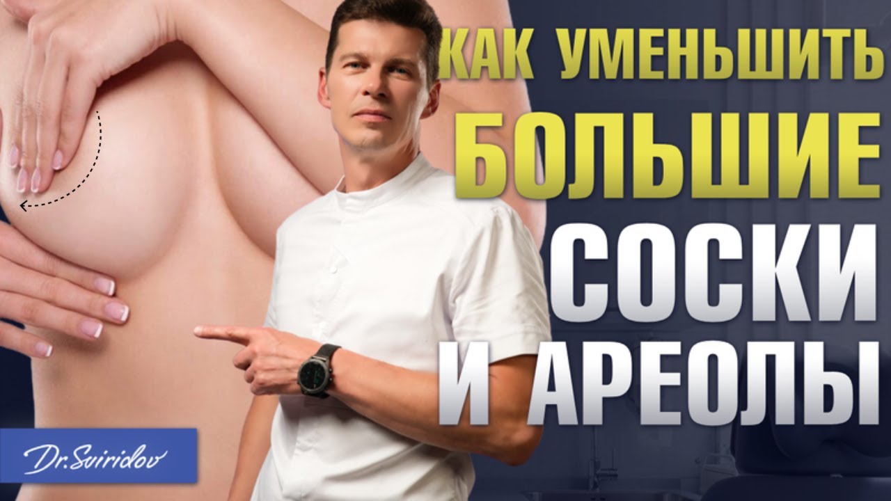 СЛИШКОМ БОЛЬШИЕ СОСКИ: Уменьшение сосков. Пластика ареол груди. Пластический хирург Сергей Свиридов