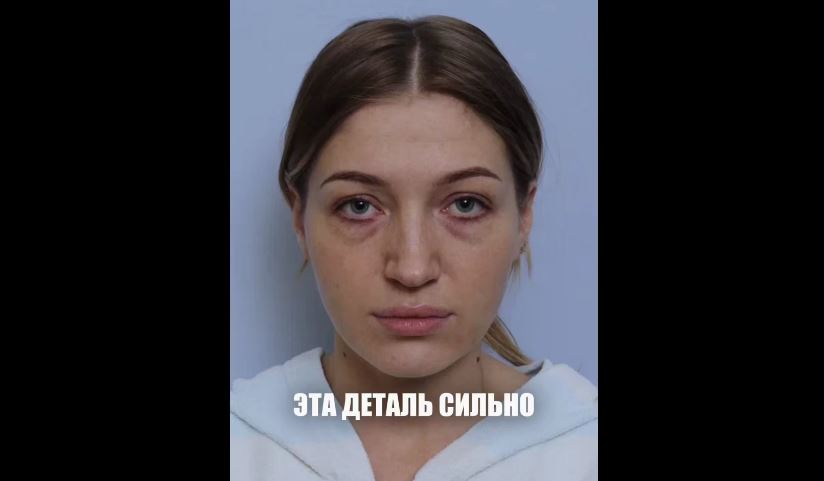 Трансконъюнктивальная методика считается одной из самых деликатных.