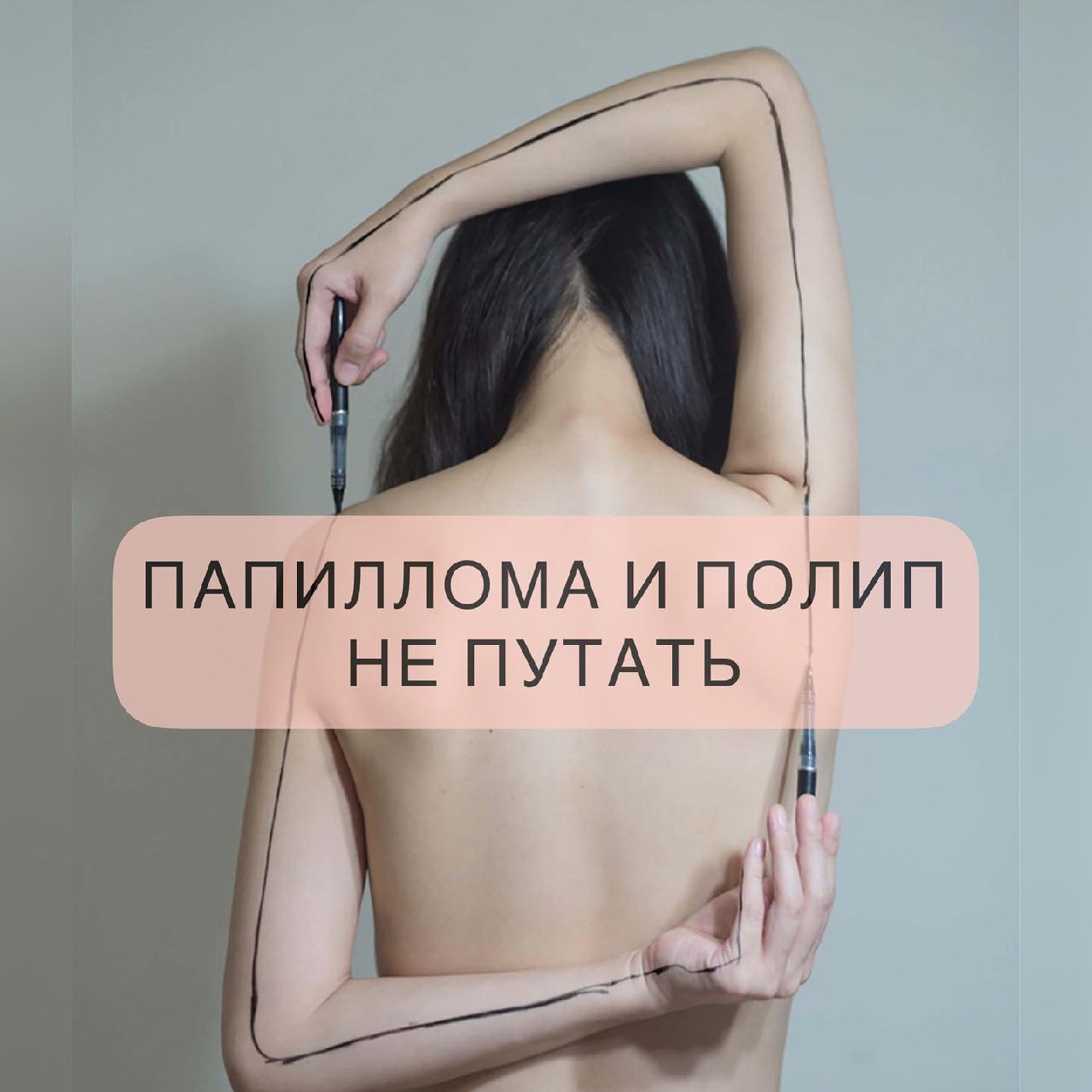 После Удаления Папиллом Можно Заниматься Сексом