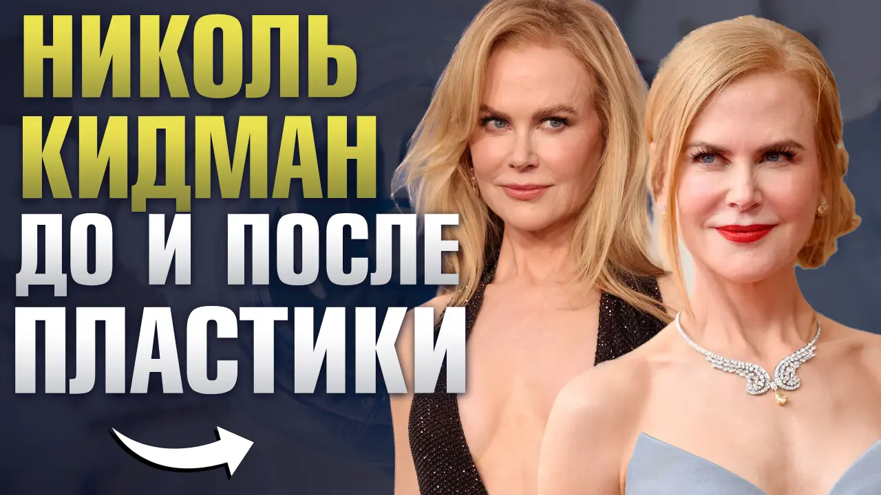 Николь Кидман до и после пластики