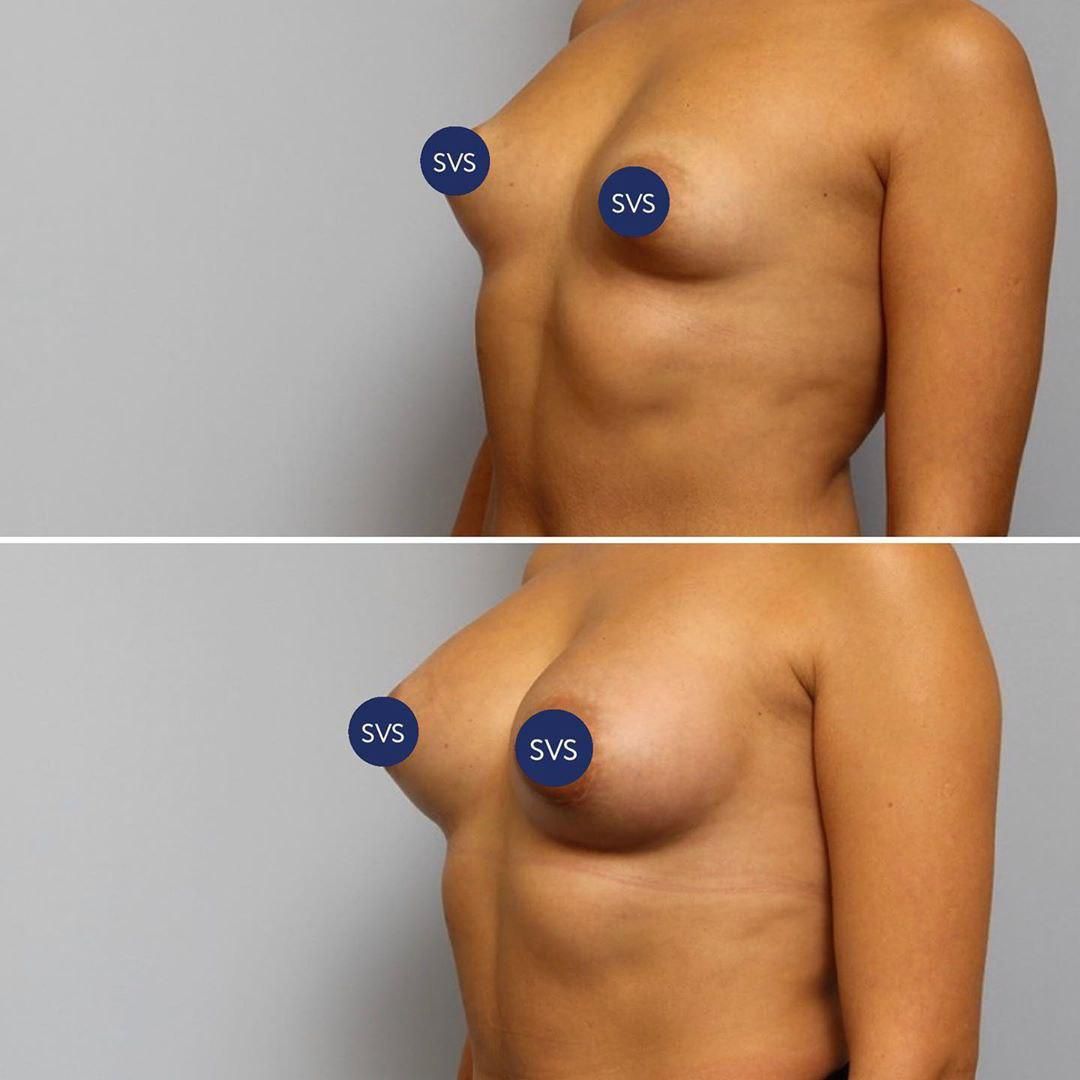 необычная форма груди у женщин фото 36