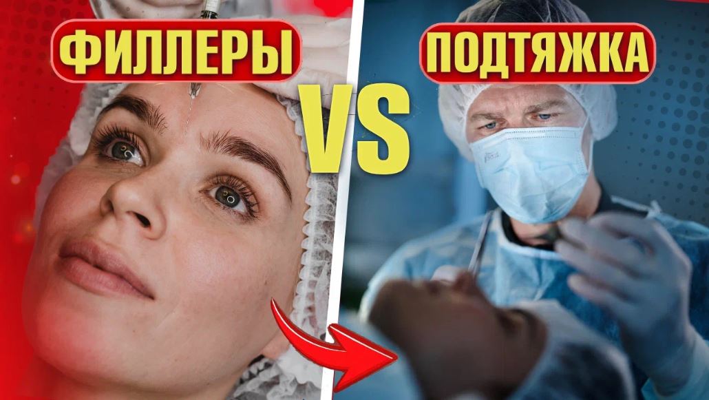 Почему филлеры не заменят подтяжку