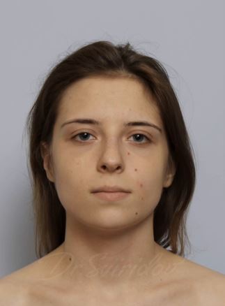 Казалось бы, зачем пациентке операция какая-либо.