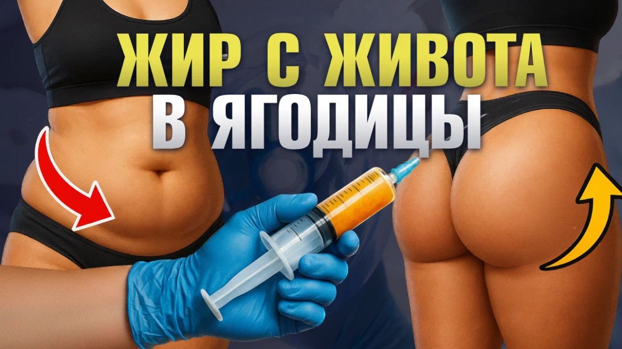 Сергей Свиридов - Липофилинг ягодиц