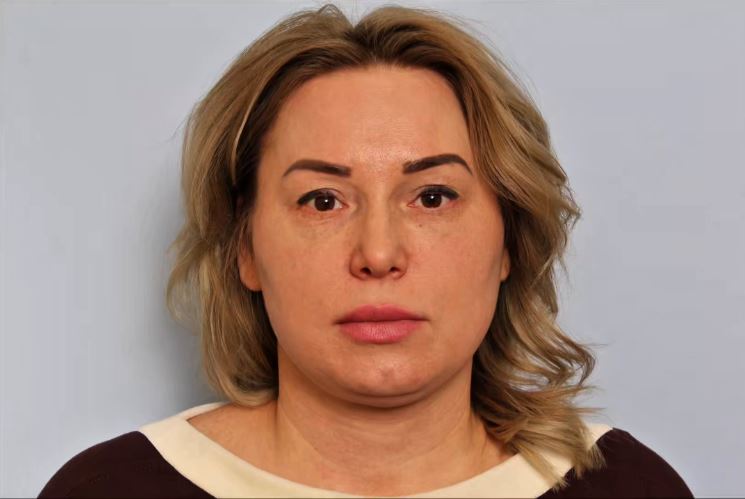 Две маленькие операции, но какой эффектный результат. 