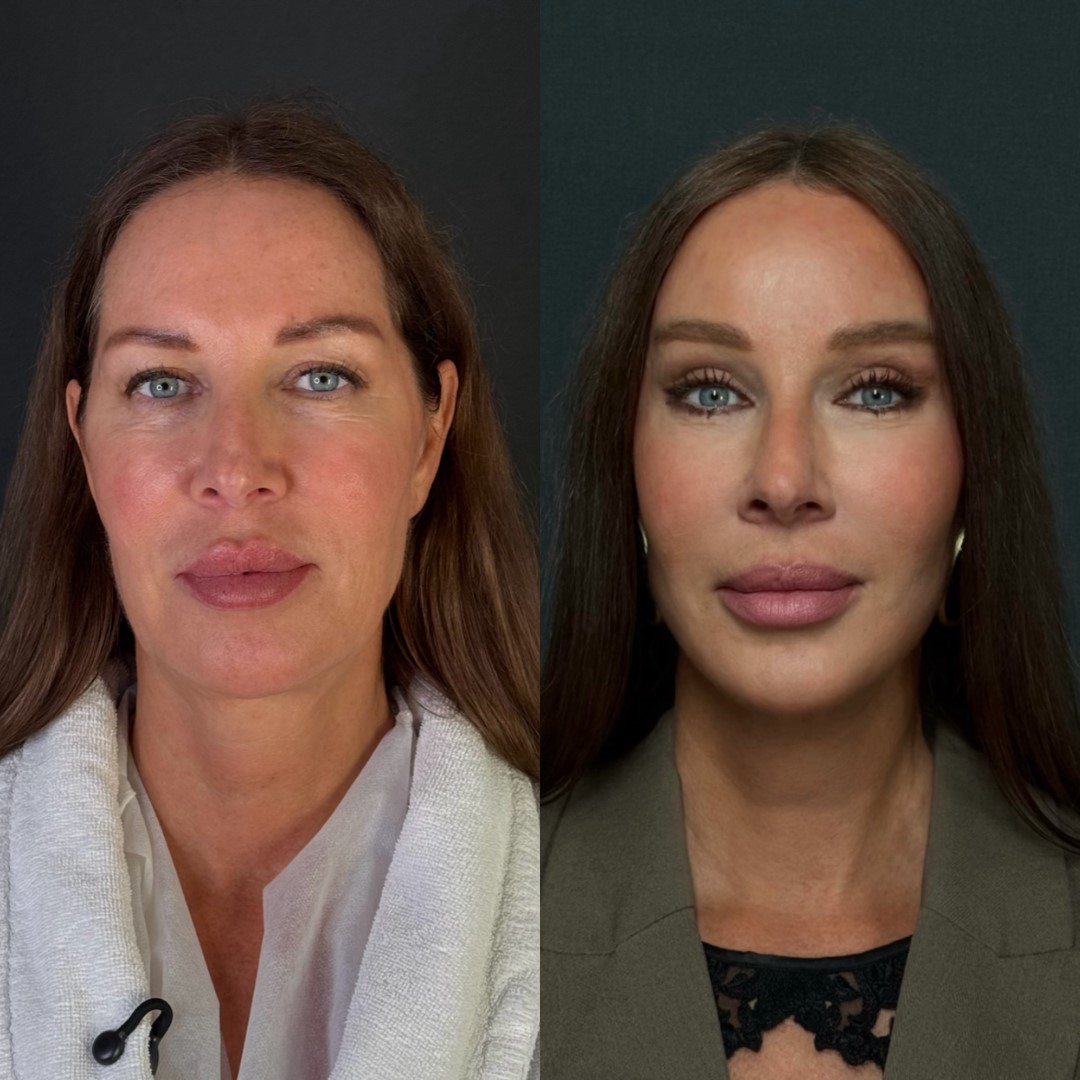 Наша прекрасная Василиса захаживала на осмотр.