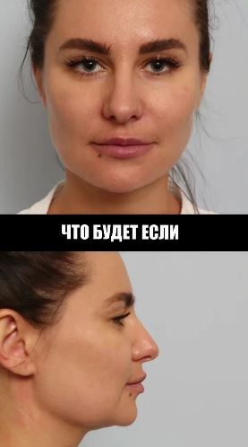 Как проходит операция и реабилитация