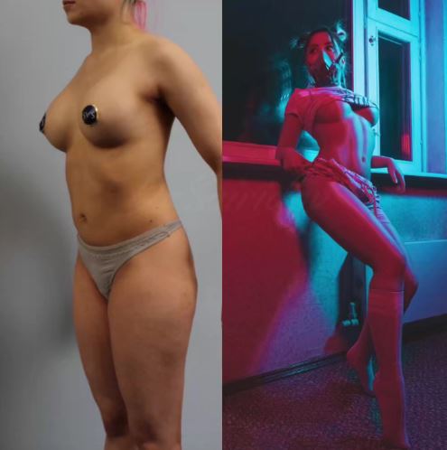 Через несколько микропроколов скорректировали фигуру со стабильным результатом. 