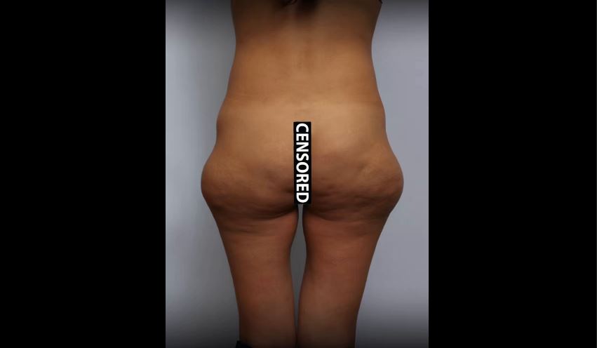 Только не говорите, что надо было пойти в спорт зал и не есть конфеты.