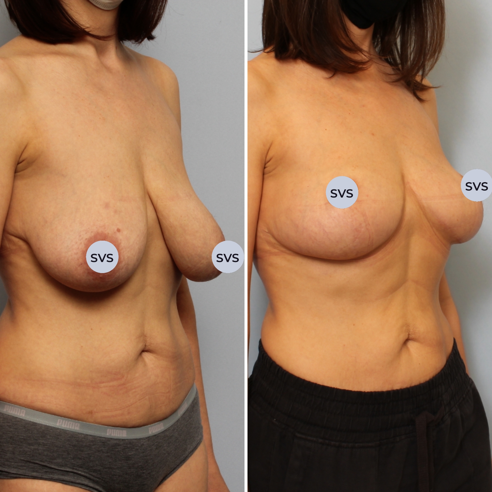 "Уши спаниеля"