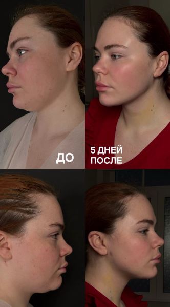 Очень много вопросов по этой операции.