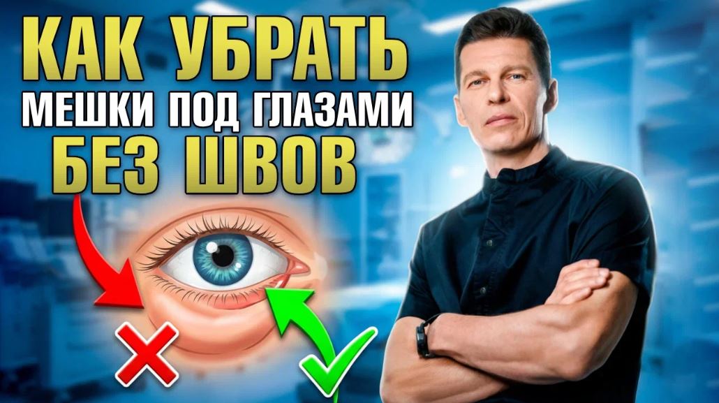 Сергей Свиридов - Трансконьюктуальная блефаропластика