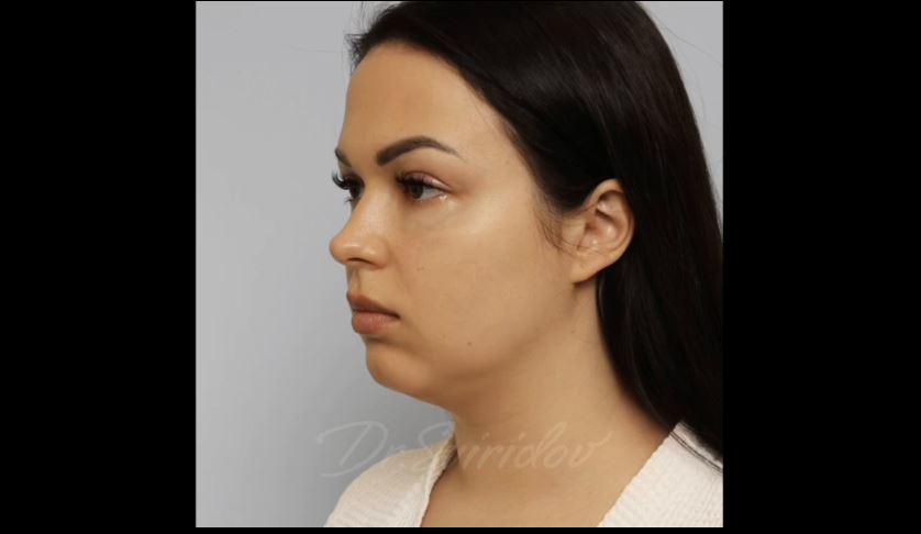 Пациентка с очень яркой и приятной внешностью.